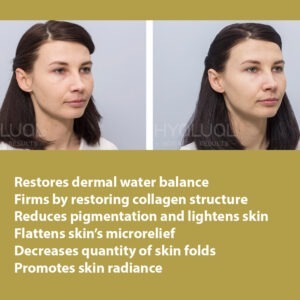 HYALUAL Xela Rederm 1.8