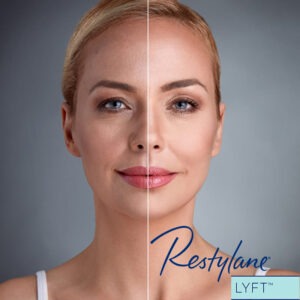 Restylane® Lyft with Lidocaine