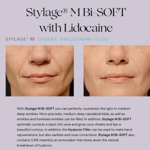 Stylage M with Lidocaine Bisoft