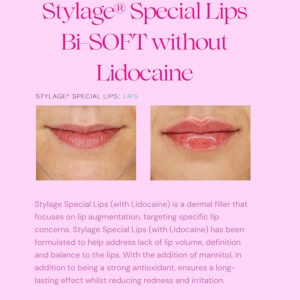 Stylage Special Lips Bisoft