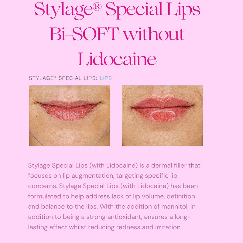 Stylage Special Lips Bisoft